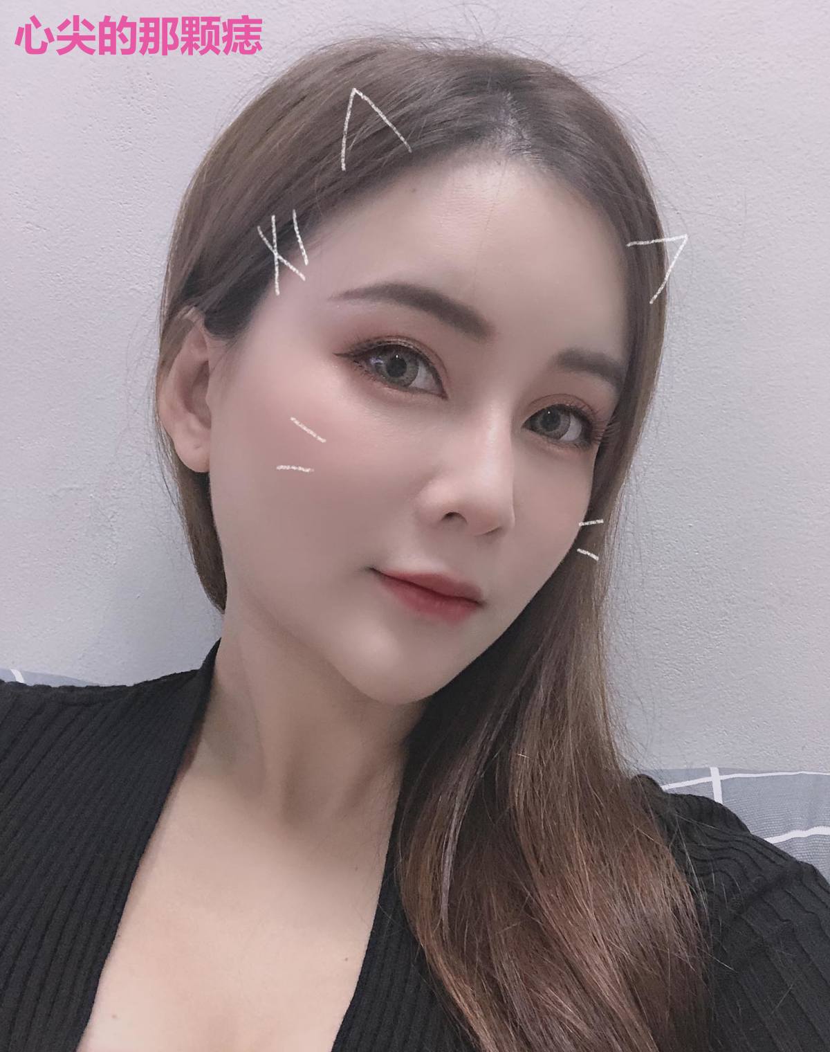 心尖的那颗痣